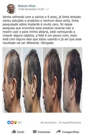 Shampoo Reverse Hair