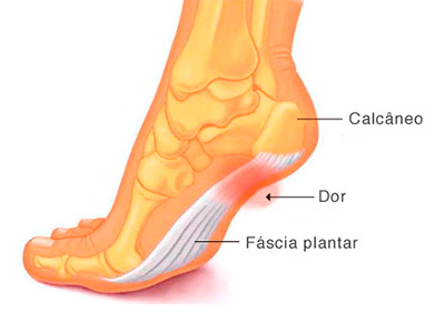 PALMILHAS PESfit