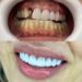 Setor de implantes dentários cresce na pandemia