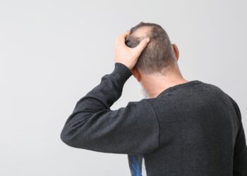Calvície tem idade para começar? Entenda o que o corpo revela sobre a saúde capilar
