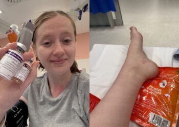 Mulher é picada por uma das serpentes mais venenosas do mundo
