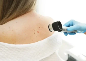 Common Skin Diseases: Symptoms, Causes, and When to Worry
