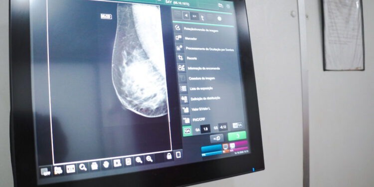 Maracanaú realiza nova ação do Outubro Rosa com 80 mamografias no dia 28 de outubro